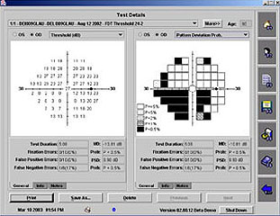 Darstellung der Messergebnisse, Humprey Matrix Technologie