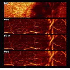 Farbcodierte HRF Analyse